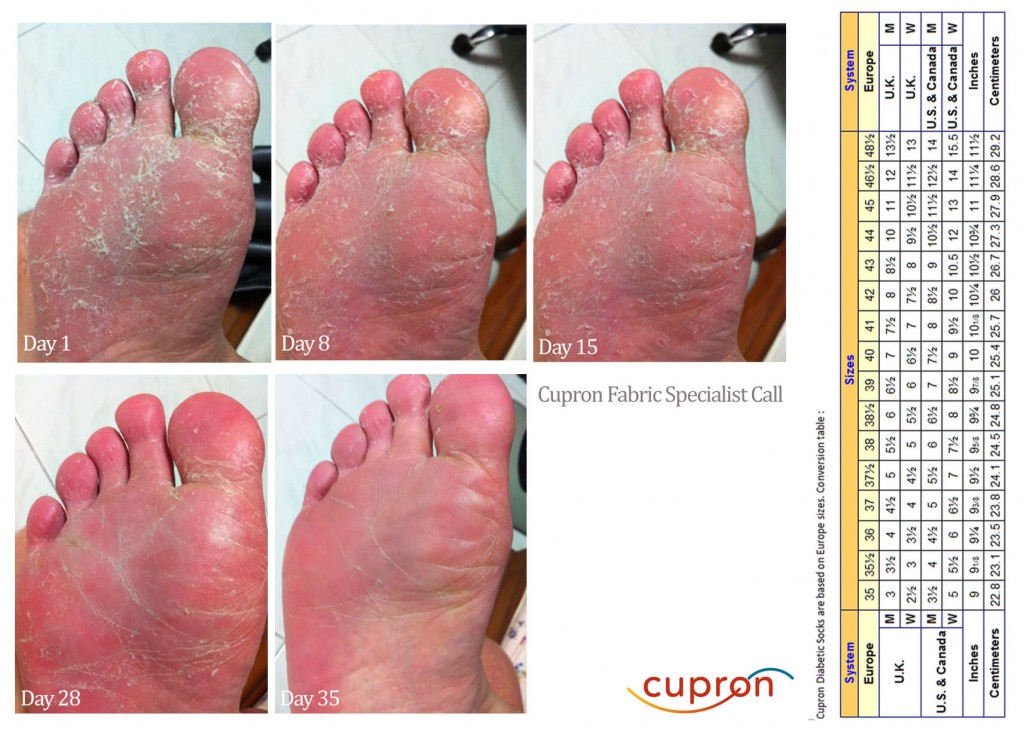 Cupron VISUAL COMPARISON