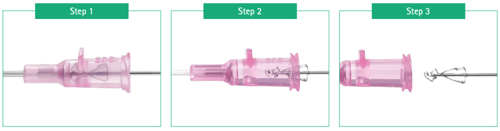 INTROCAN WINGED IV CATHETER Safety Feature