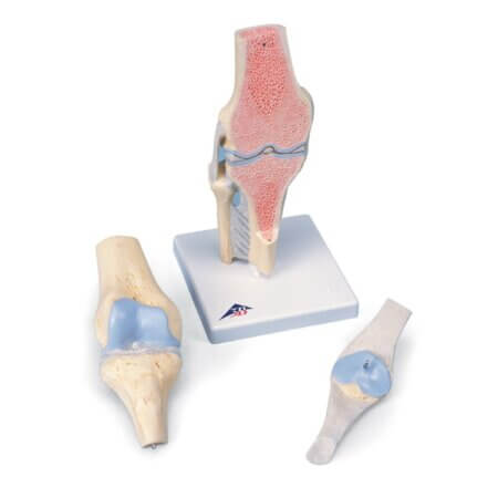 Sectional Knee Joint Model, 3 part