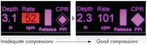 ZOLL cpr_feedback