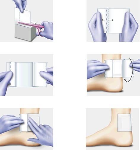 HARTMANN OMNIFIX ELASTIC NWOVEN TAPE Usage